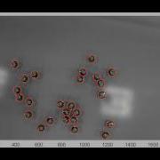 Kilobots Localization With Circle Tracking Using Microsoft Kinect