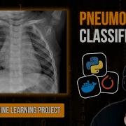 Full Machine Learning Project Train Deploy A Pneumonia Classifier In PyTorch