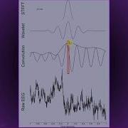 Frequency Resolution Of Wavelet Convolution