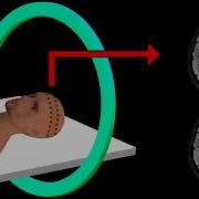 PET Scan How It Works Animation