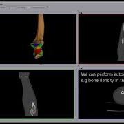 Interactive Segmentation And Measurement