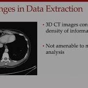 Stanford Radiology PHIND Summer 2022 Chaudhari Disease Prediction Using Imaging Deep Learning