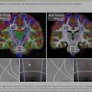 IEEE 2014 IMAGE PROCESSING A MATHEMATICAL FRAMEWORK FOR THE REGISTRATION AND ANALYSIS OF MULTI FASCI
