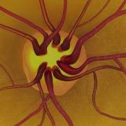 Animation Dilated Eye Exam