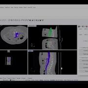 Tutorial Segmentation Region Growing