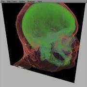 Demo Direct Volume Rendering