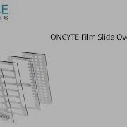 ONCYTE Film Slide Overview
