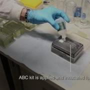 ImmunoHistoChemistry IHC Video Protocol Series
