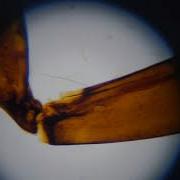 Honey Bee Worker Leg Under Microscope