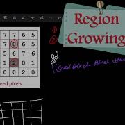 شرح موضوع Image Segmentation Region Growing بالتفصيل
