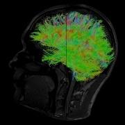Connectome From Diffusion Tensor Imaging DTI