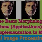 Some Basic Morphological Algorithms Applications In DIP And Its Implementation In MATLAB Image