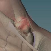 Mayo Clinic Minute Cause Remedies For Thumb Arthritis