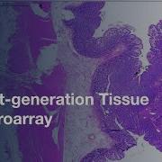 Next Generation Tissue Microarray NgTMA Biomarker Studies Protocol Preview