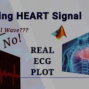 Plotting Real Time ECG Signal In MATLAB CADDD Academy