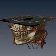 3D Visualization Of A Head CT Scan