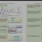 ECG Data Analysis Video