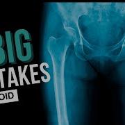 Don T Do This After Hip Surgery Or Risk Dislocation