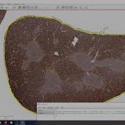 Cell Counting In QuPath