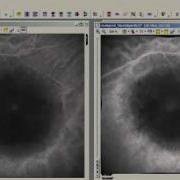 AutoQuant Alignment Controller