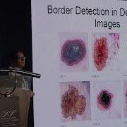 Density Based Clustering DBSCAN And OPTICS By Mainak Sen Data Science Summit 2017
