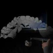 3D Dental Scanner Flying Triangulation