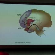 The Brain Is Our Last Frontier And Consciousness Is Expanding Dr Heather Berlin TEDxYouth KC