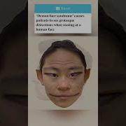 Here S What Human Faces Look Like To People With Prosopometamorphopsia AKA Demon Face Syndrome