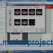 Prostrate Cancer Detection Image Processing Matlab Projects