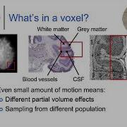12 Preprocessing FMRI Data Realignment And Interpolation