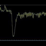 Real Time Arterial Input Function