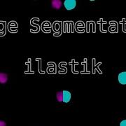 Image Segmentation With Ilastik Pixel Classification
