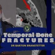 TMT Temporal Bone Fractures By Dr Barton Branstetter