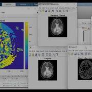 Canny Edge Detection In Matlab Code To Detect Edges Edge Detection Matlab