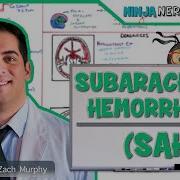 Subarachnoid Hemorrhage Etiology Pathophysiology Clinical Features Treatment Complications