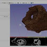 Using ImageJ FIJI And 3D Slicer To Visualize MicroCT Image Stack Video Tutorial