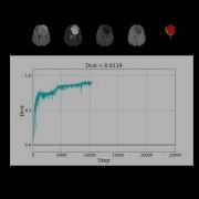 Training A Neural Network For Brain Tumor Segmentation
