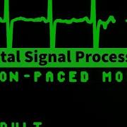 DSP Developing 8 Point Radix 2 DIT FFT Algorithm Part 1