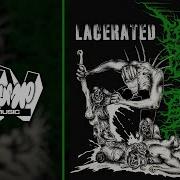 ENDLESS DECAY LACERATED EXCLUSIVE OFFICIAL VISUALIZER ChumpTV MUSIC