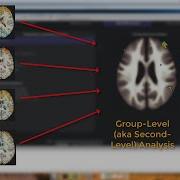 CONN Tutorial 9 Group Level Analysis