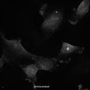 Membrane Ruffling LN229 Cells Label Free 3D Live Cell Imaging