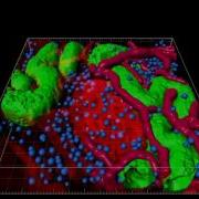 Imaris Isosurface Rendering Spots Detection