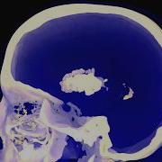 A TikToker Inhaled Whipped Cream Propellant And It Ruined His Life