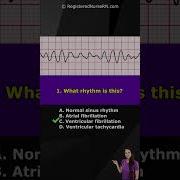 ECG Rhythm Pop Quiz Can You Identify These EKG Rhythms Shorts