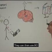 What Is Brain Computer Interface And How Can It Help Stroke Patients Recover Mobility