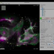 Interactive Alignment Of Spatial Transcriptomics Datasets Using STIM