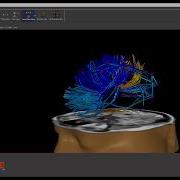 NeuroNavigator