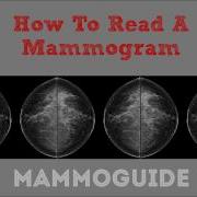 How To Read A Mammogram