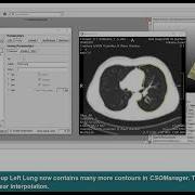 MeVisLab Tutorials Contours Interpolation Between Contours