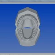 Orthotech 3 D Digital Model Viewer